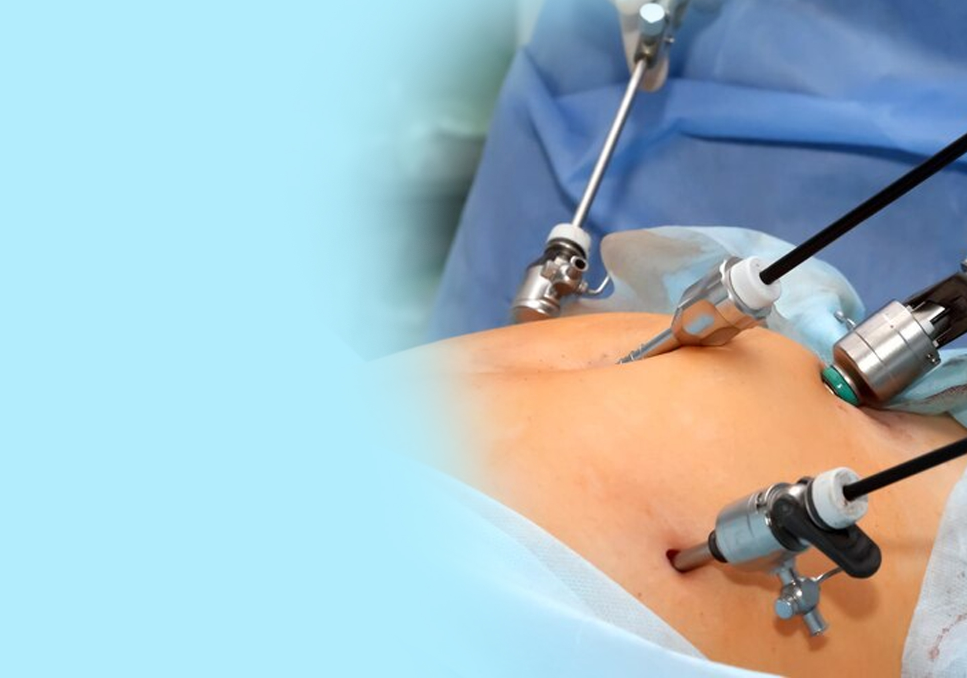 Laparoscopic Surgery: Risks, Benefits, and Recovery